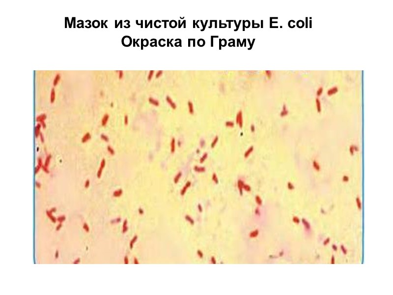 Мазок из чистой культуры E. coli Окраска по Граму